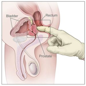 The rectal anatomy of men.